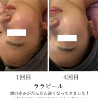 画像1740：施術事例