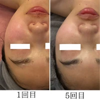 画像1748：施術事例