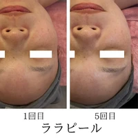 画像1750：施術事例