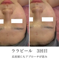 画像1752：施術事例