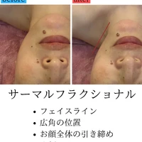 画像1754：施術事例