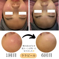 画像1758：施術事例