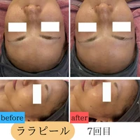 画像1760：施術事例
