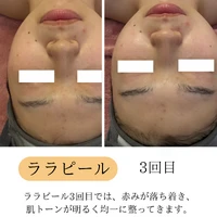 画像1762：施術事例