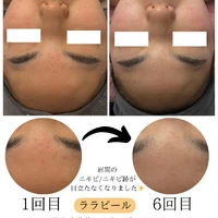 画像1764：施術事例
