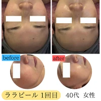 画像1768：施術事例