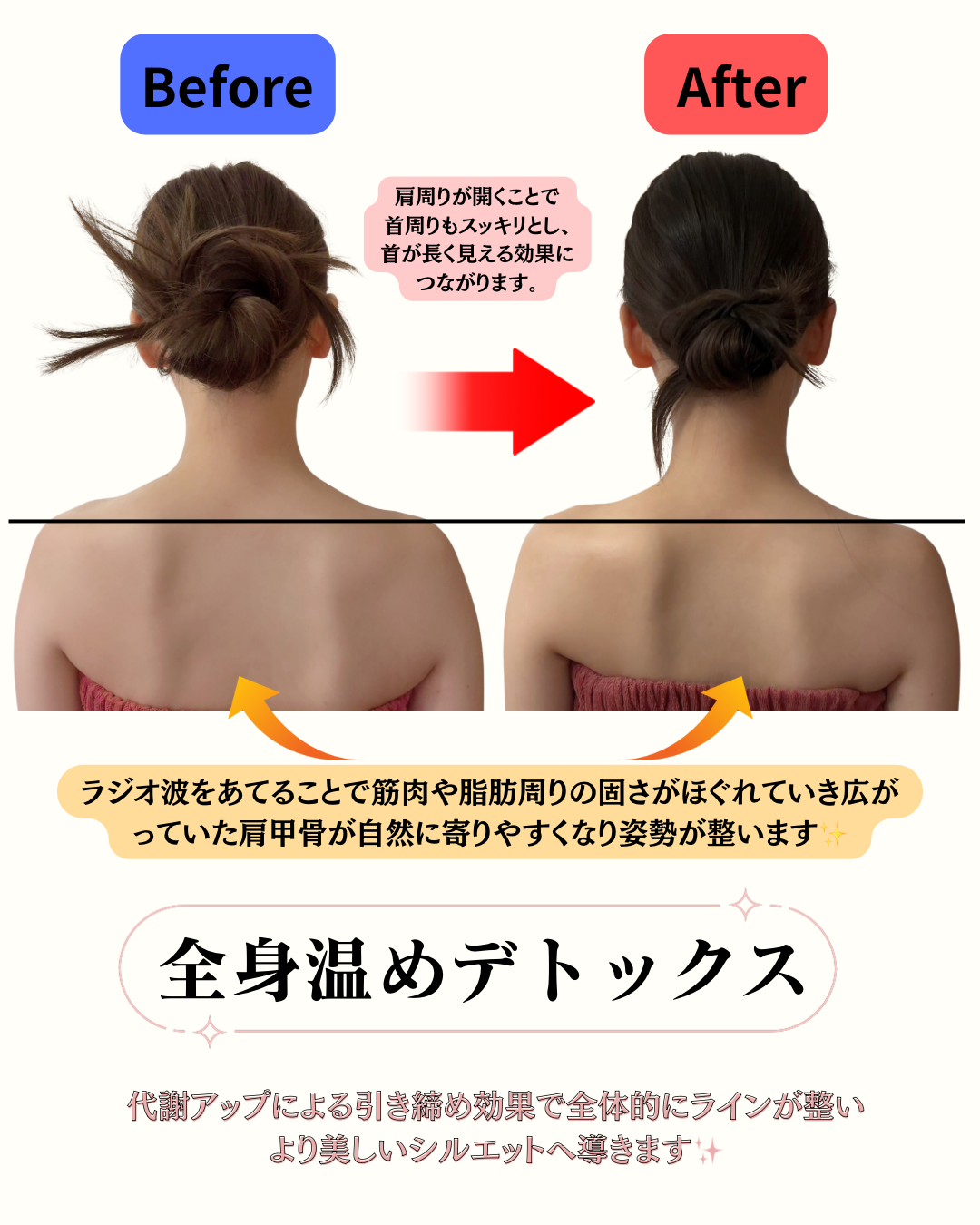 🍁【秋の冷え・むくみ・凝り対策】ラジオ波で内側から温めて、巡りのいいカラダへ