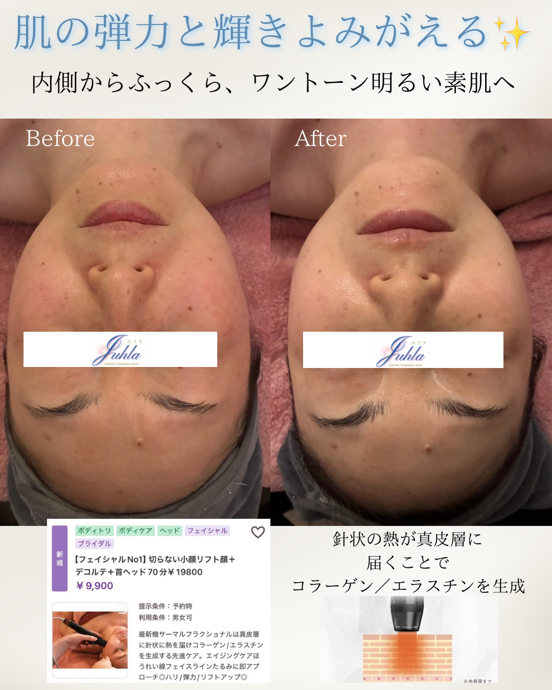 ✨肌の弾力と輝き、よみがえる✨ 内側からふっくらワントーン明るい素肌へ💎