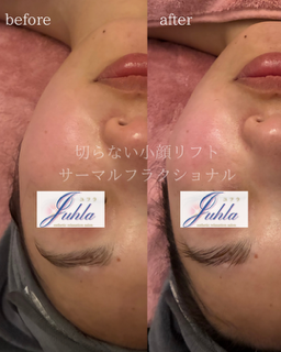 年齢に負けない肌へ。たるみが気になり始めた今こそできる対策🌿