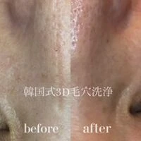 画像4380：施術事例